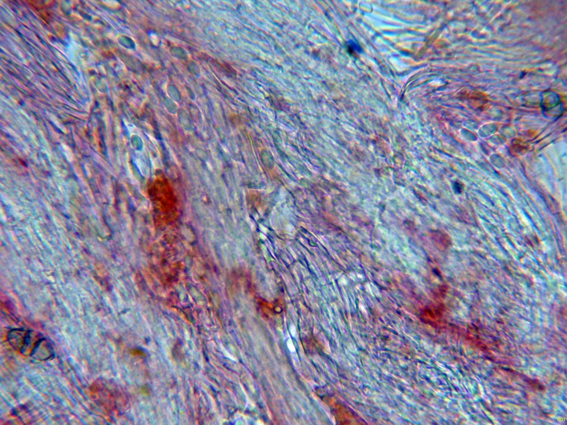 Microscopía de Stilbella fimetaria - 9 - Hifas-001